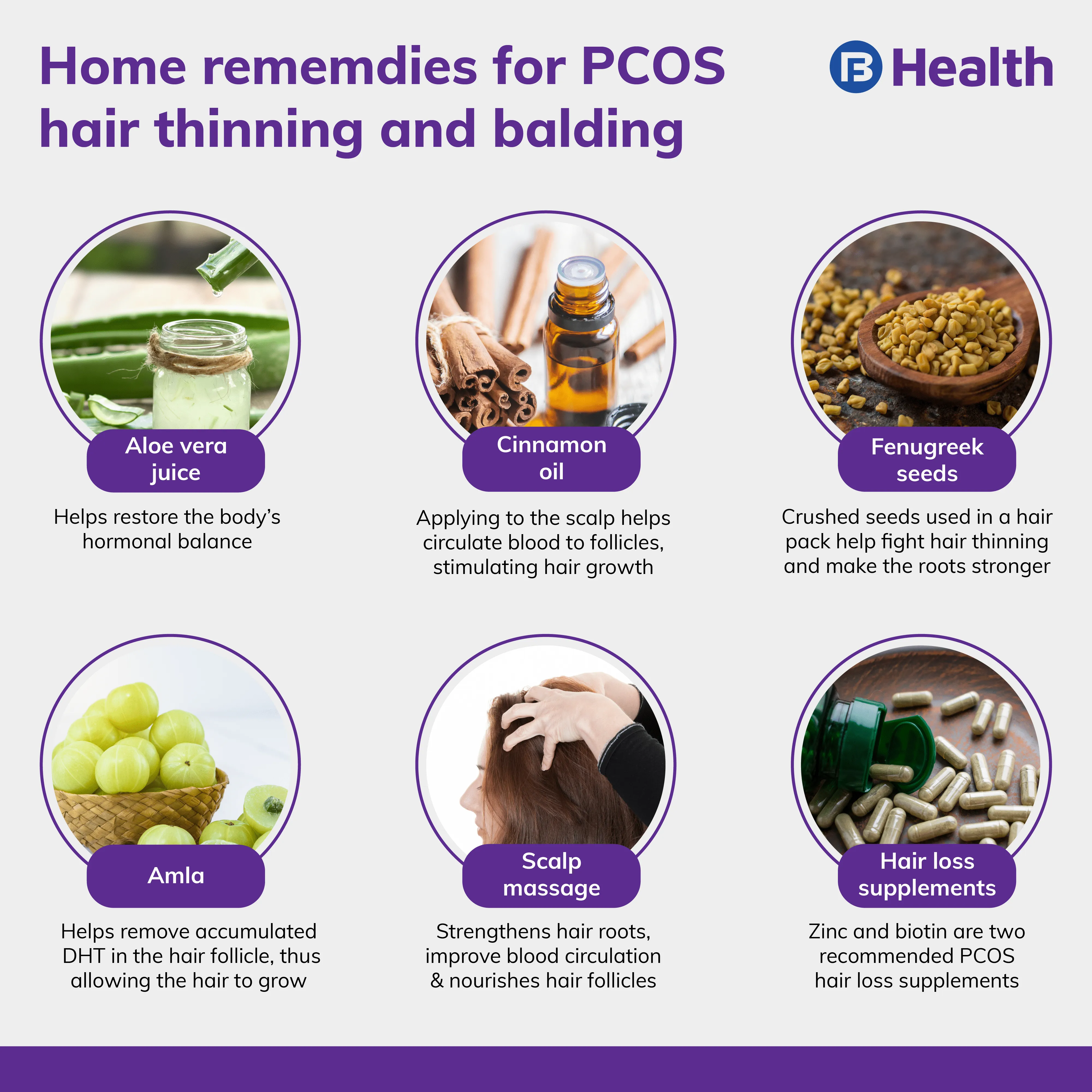 PCOS hair loss home remedies
