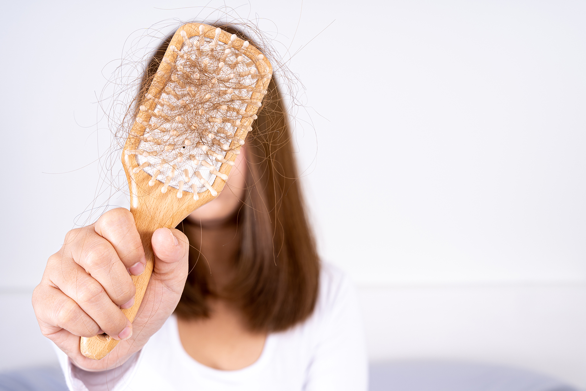 PCOS Hair Loss: Causes, Treatment and Home Remedies