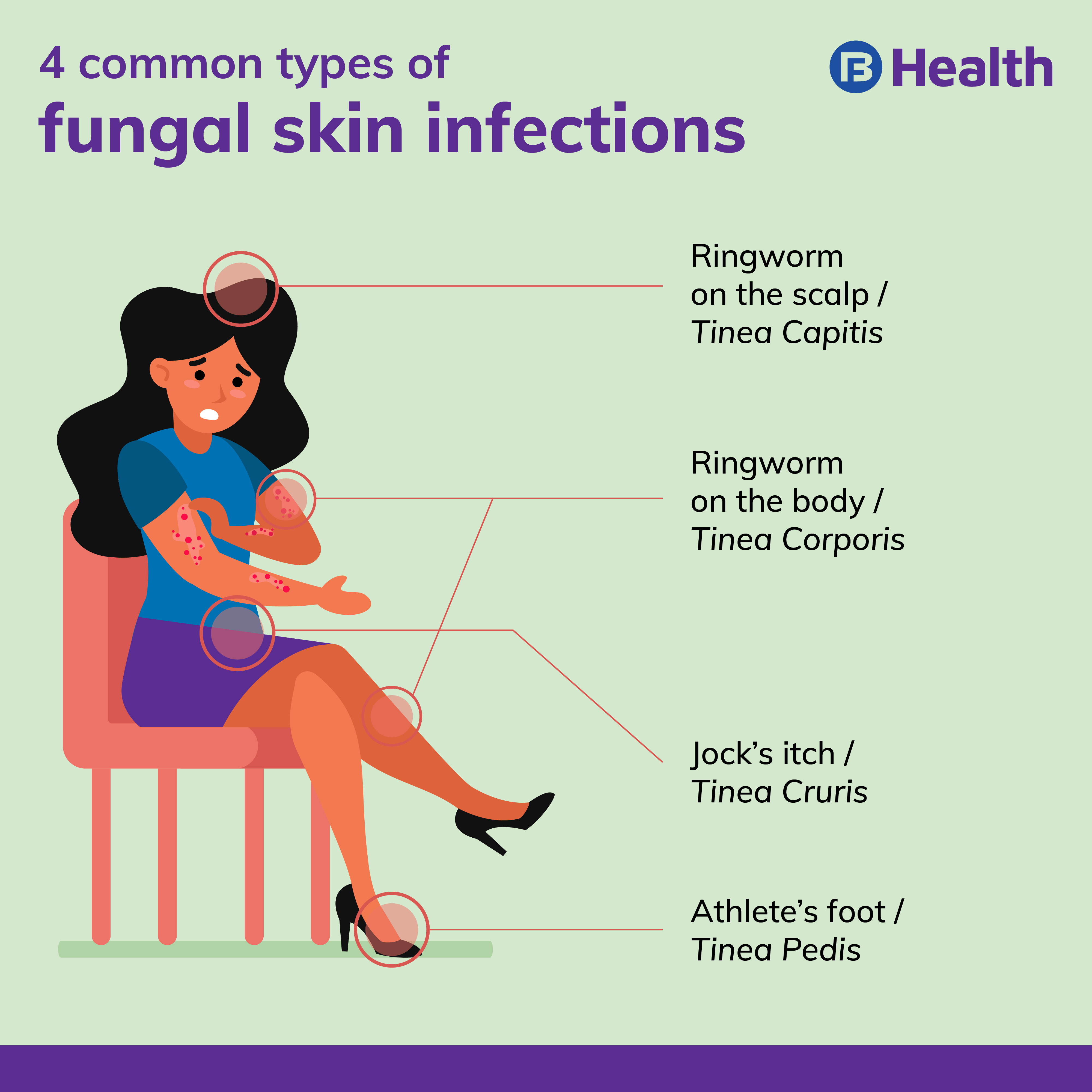 Home Remedies For Fungal Infection  