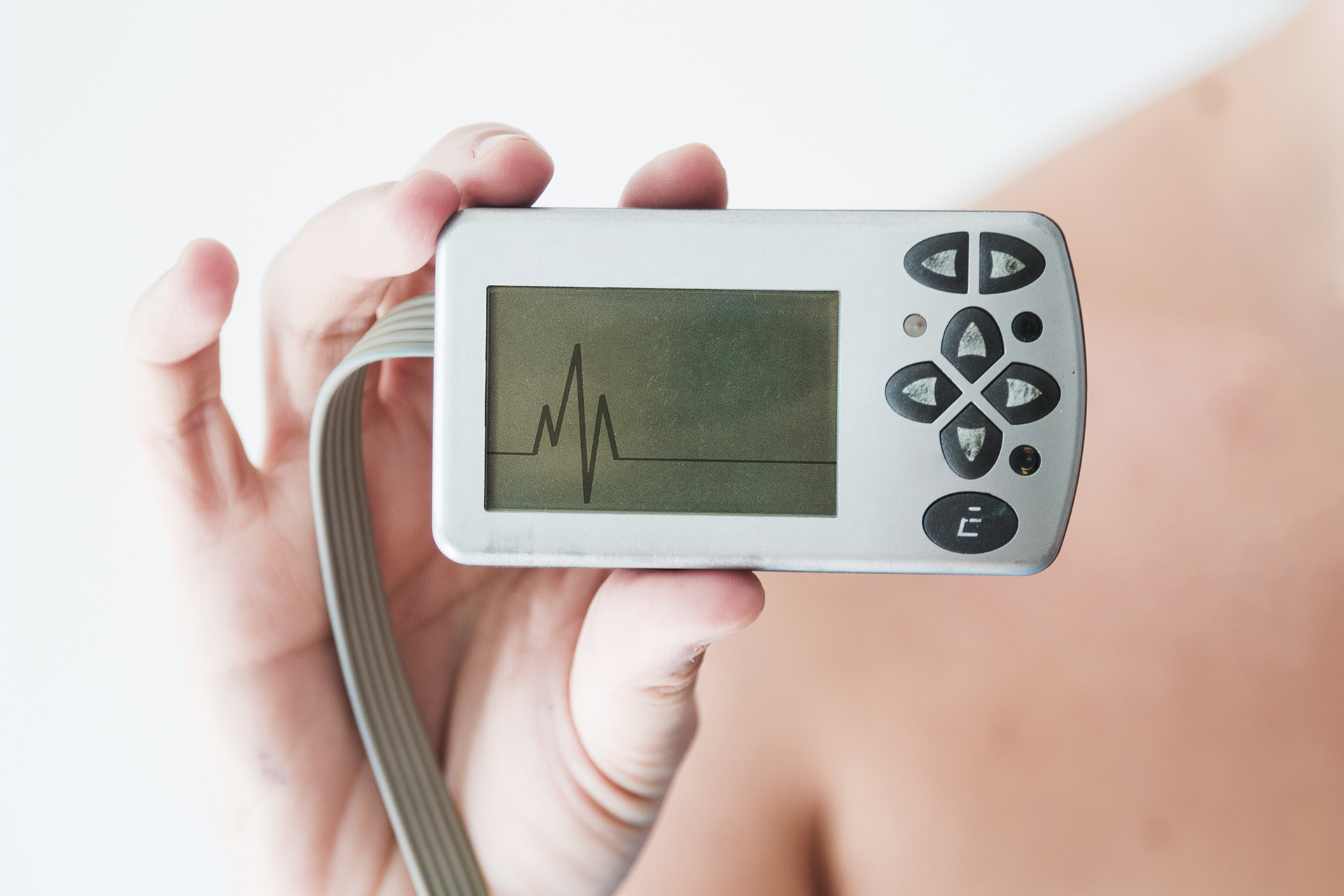 Electrocardiograph (EKG): Type, Result and Process