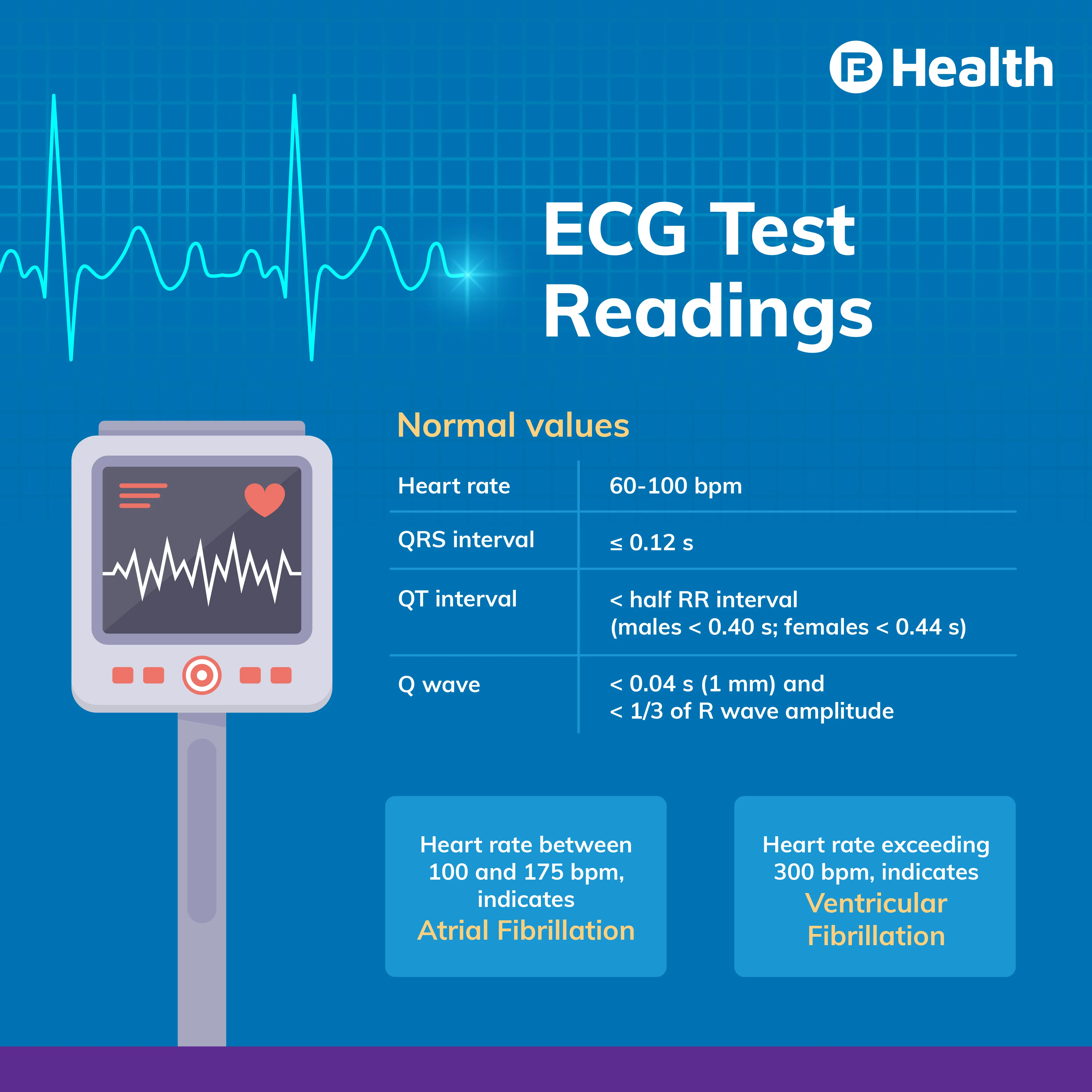 ECG test readings