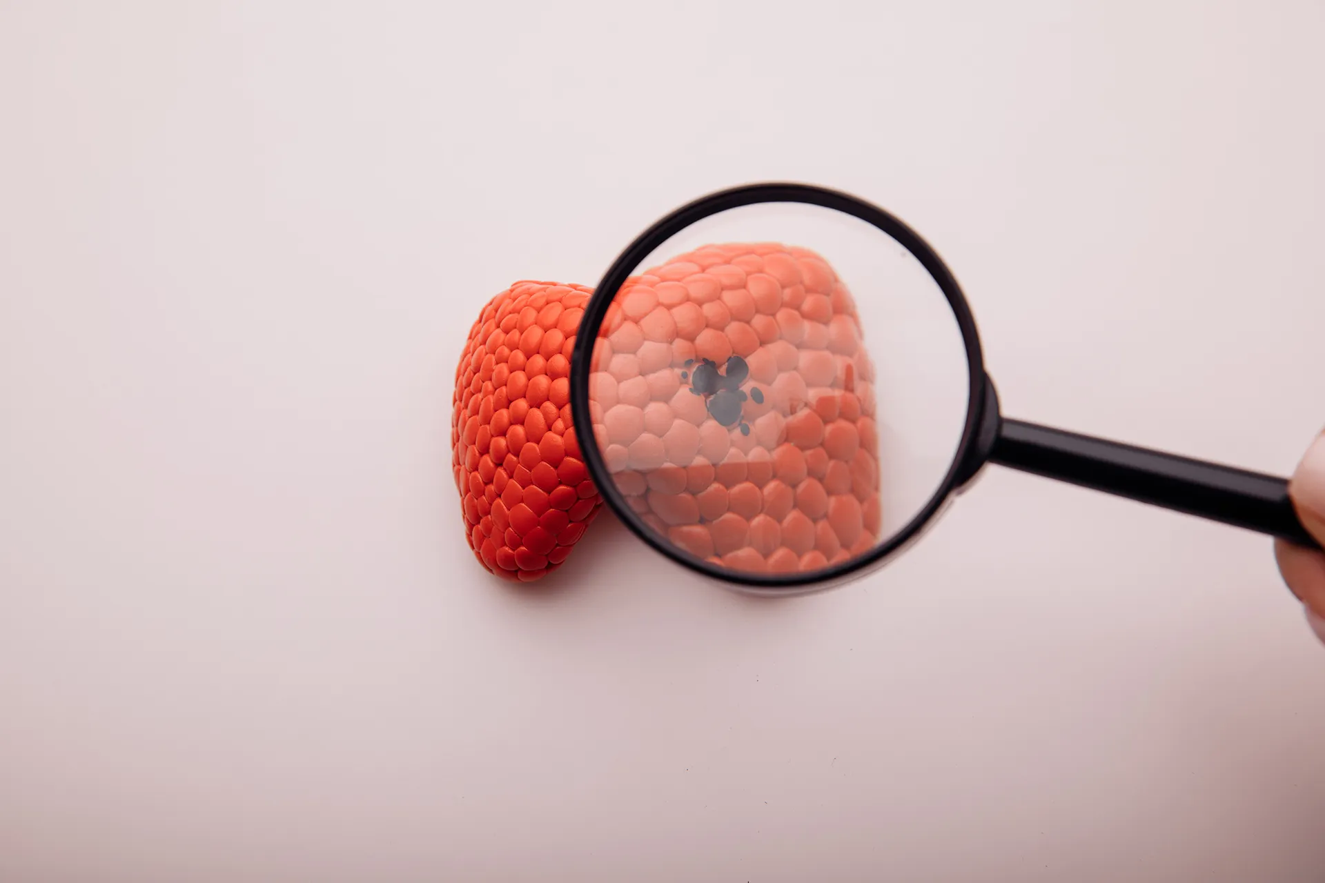 Thyroid eye disease prevention