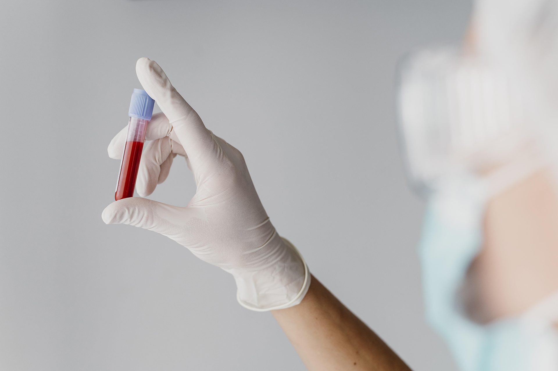 Blood Group Test: How it is Done and What are the Different Blood Types?