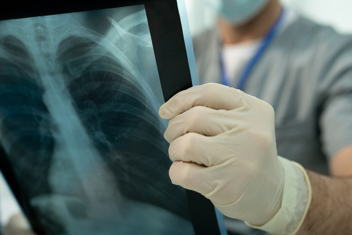 Lung Diffusion Test: What it is and Why it is Done? Important Things to Know!