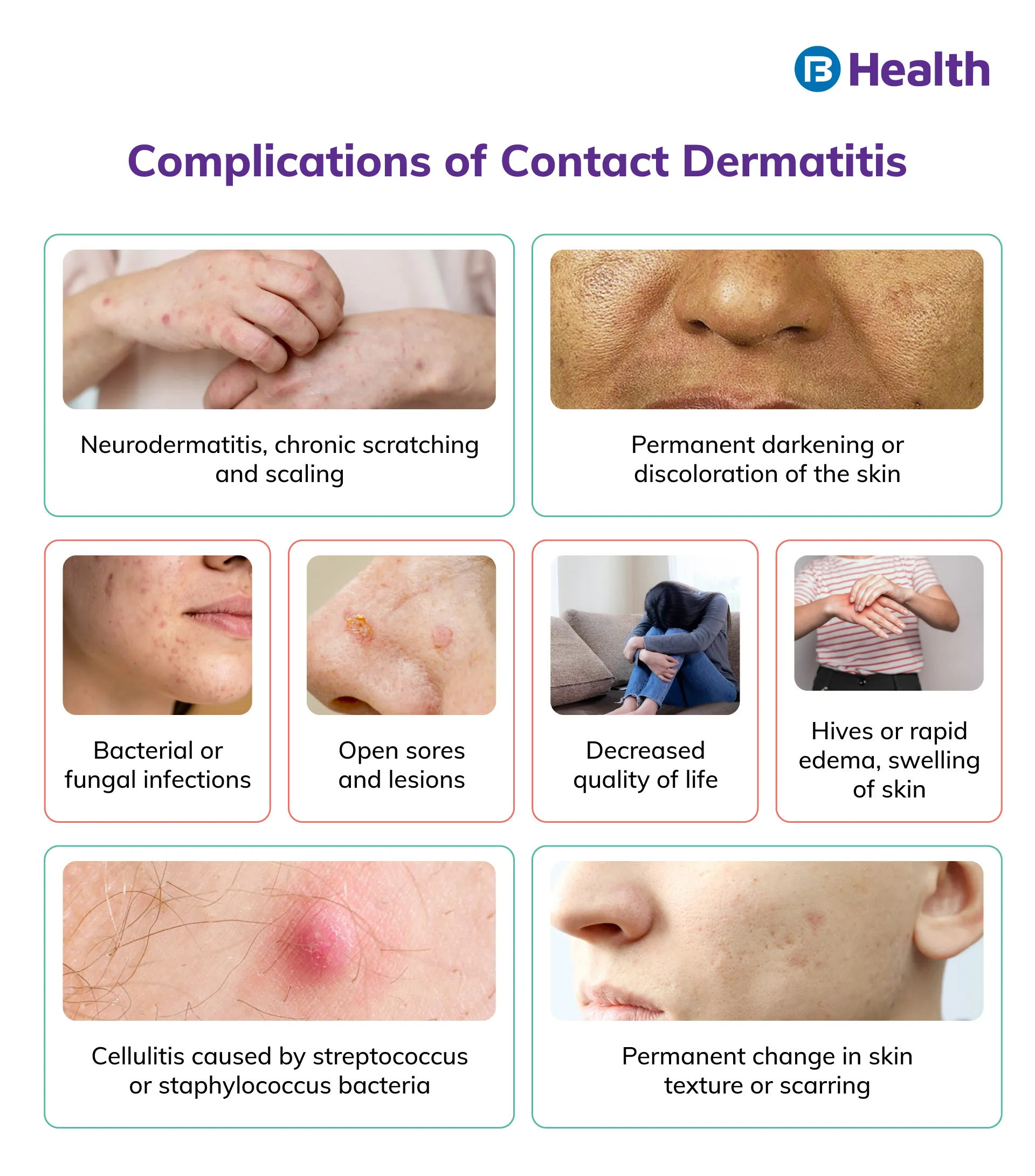 contact dermatitis complications