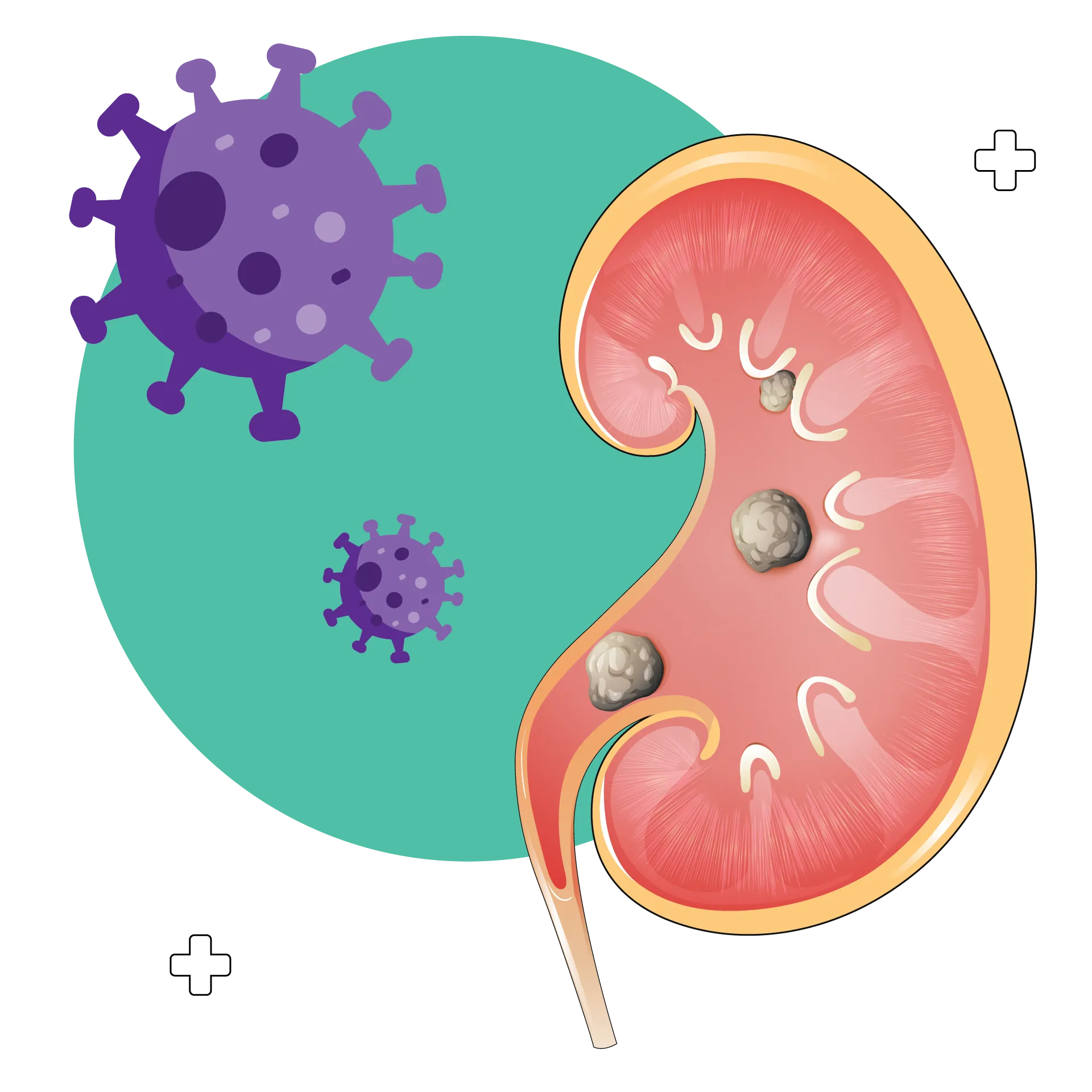 Kidney Disease and COVID-19: A Guide - 10