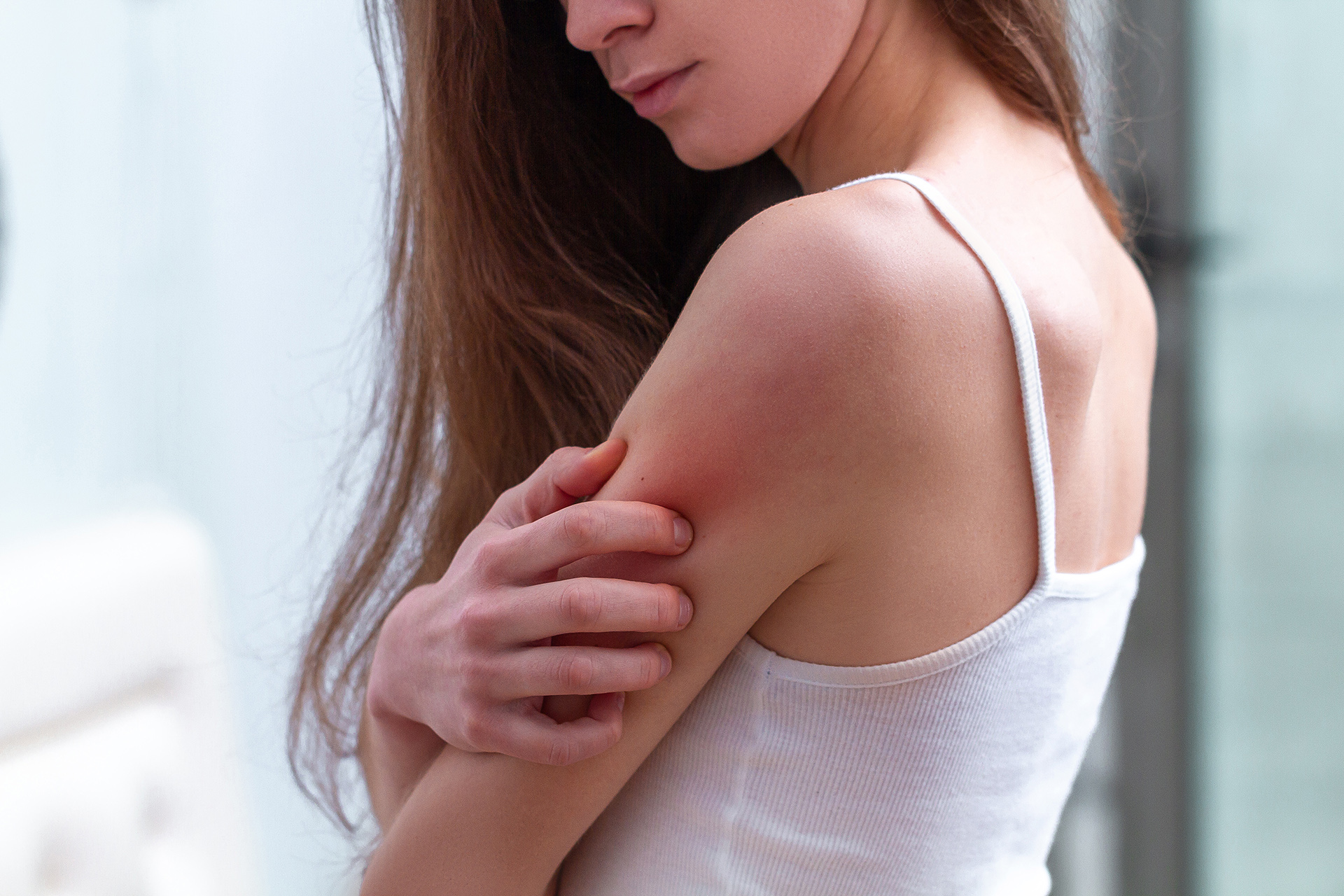 A Guide to Eczema: Its Causes, Symptoms and Treatment?