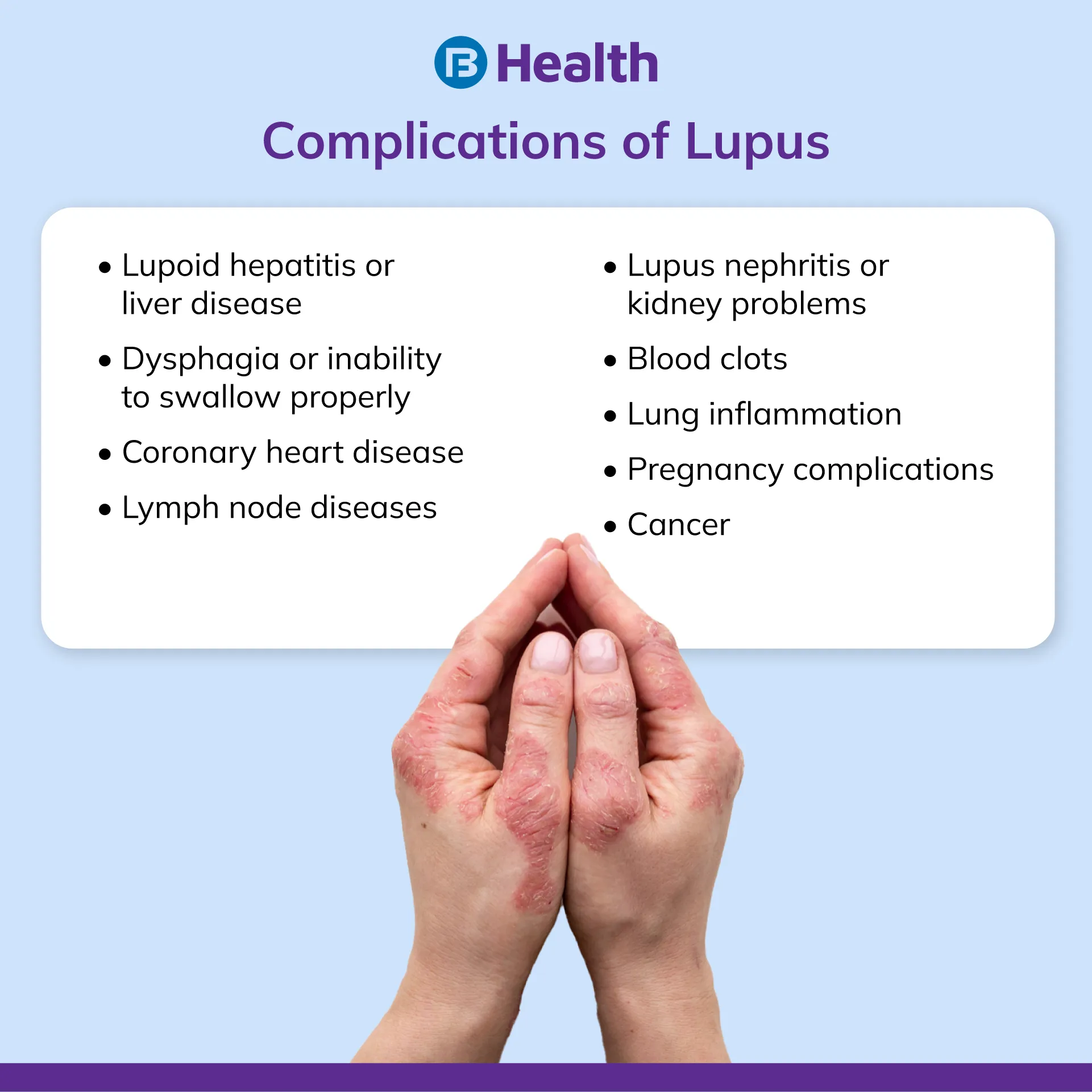 Complications of Lupus Disease