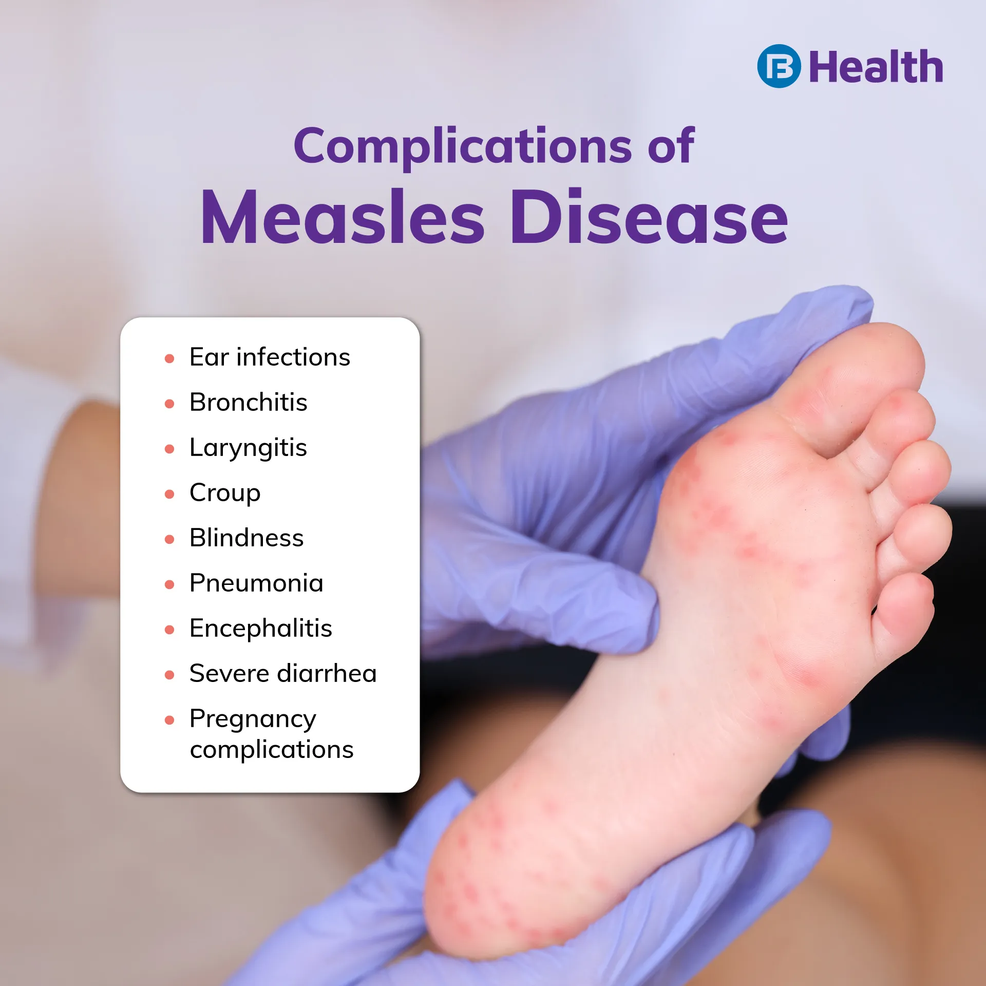 Measles disease complications