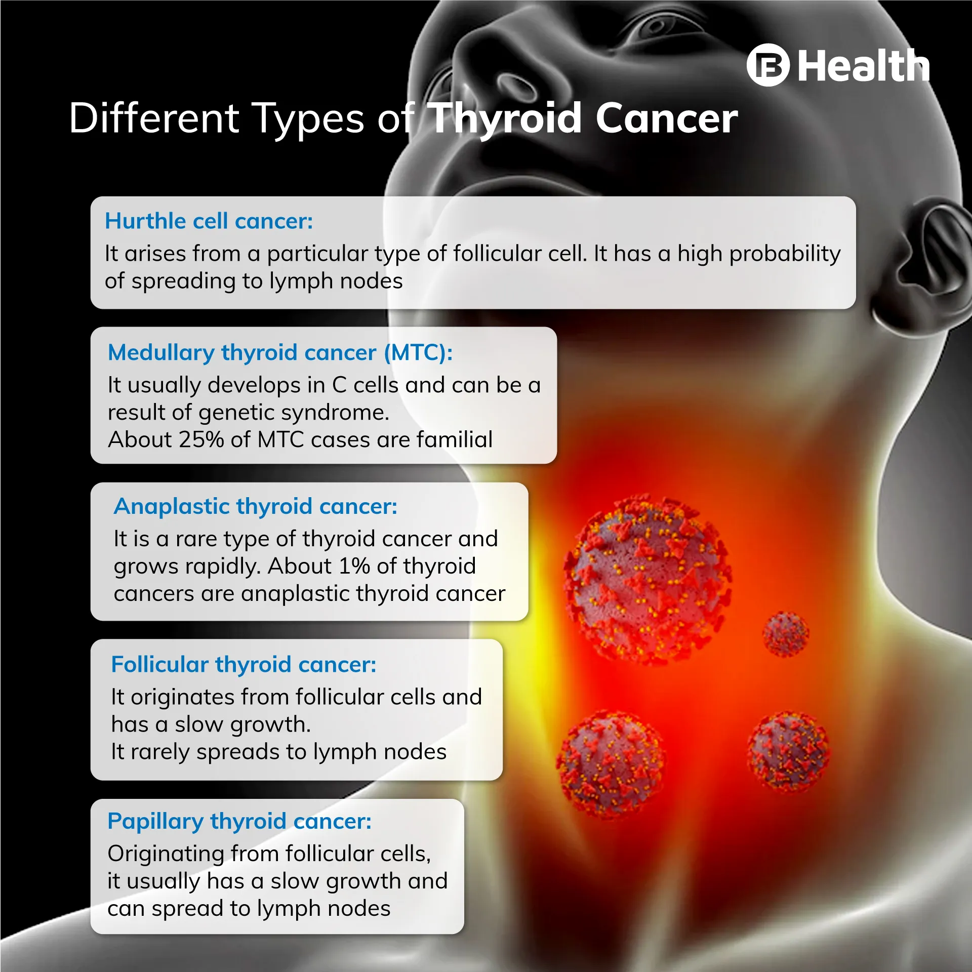 thyroid cancer types