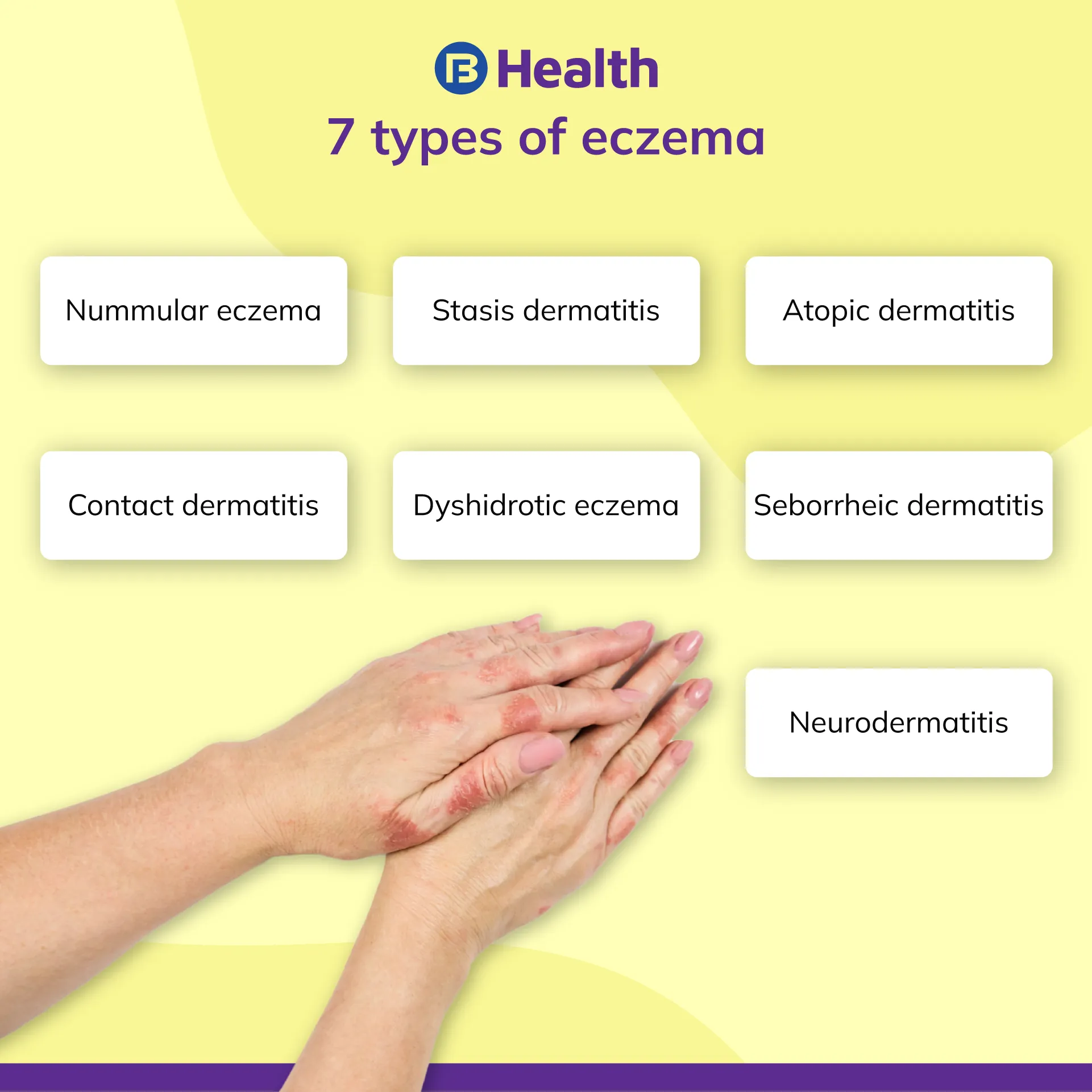 Eczema types