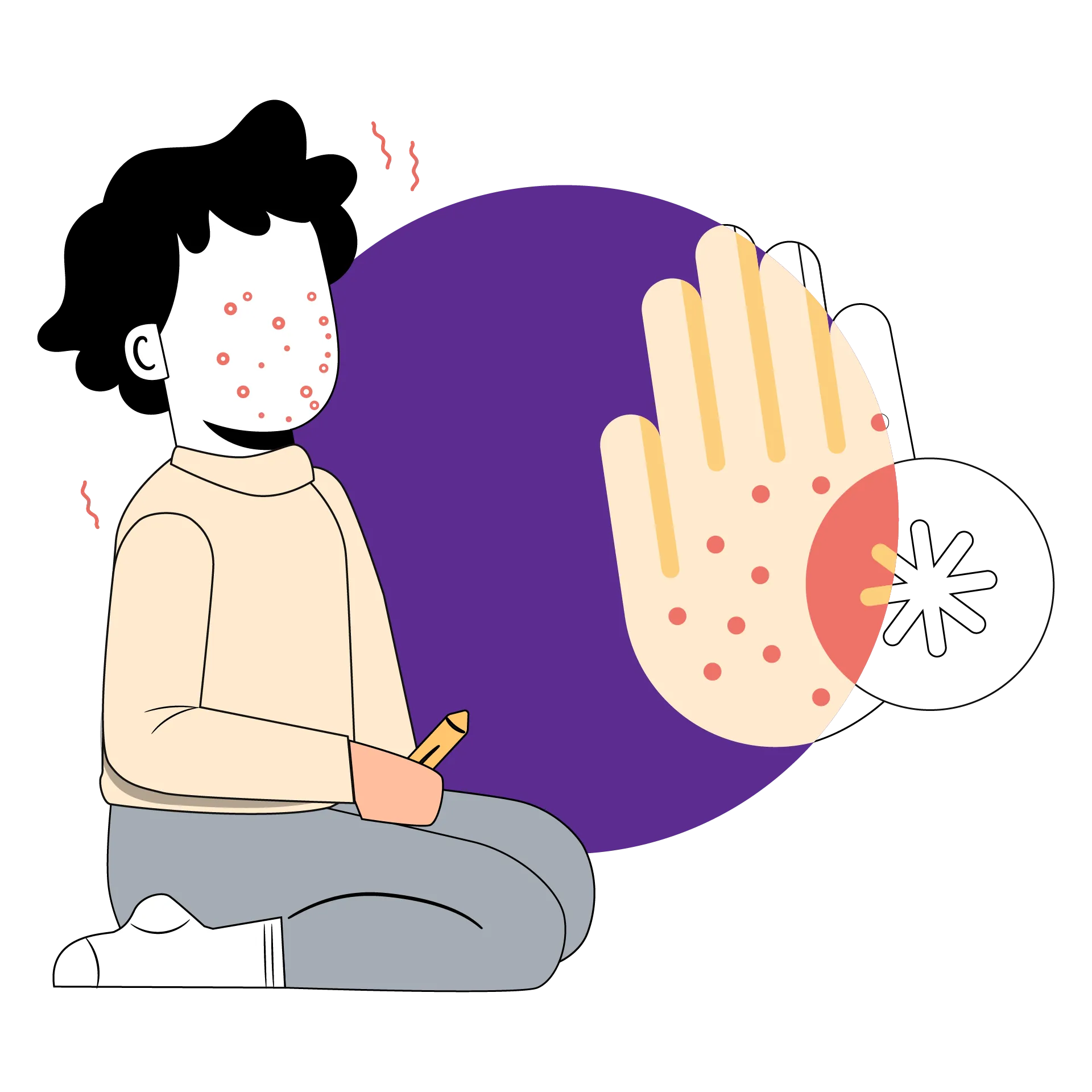 guide to Chickenpox -24