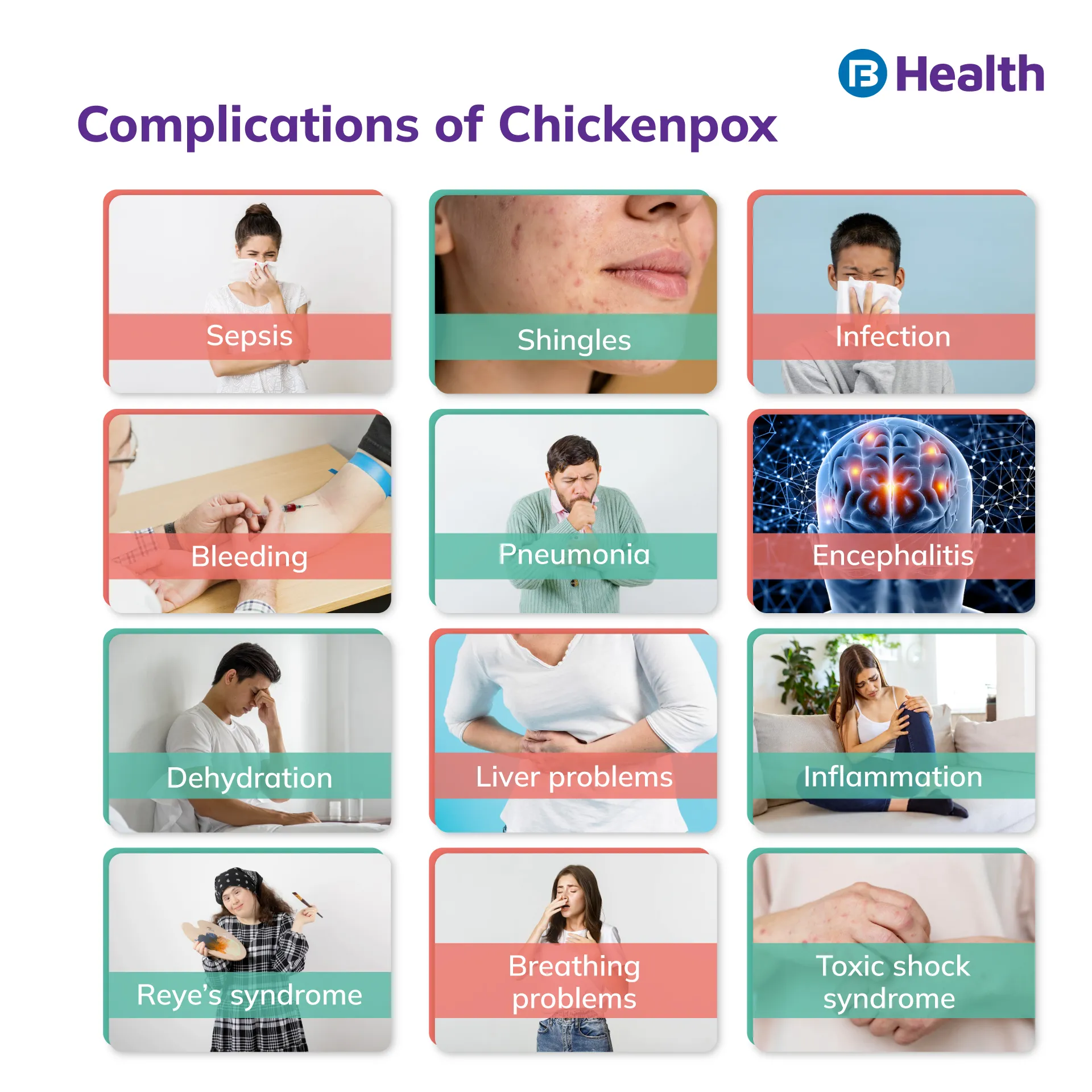 Chickenpox complications