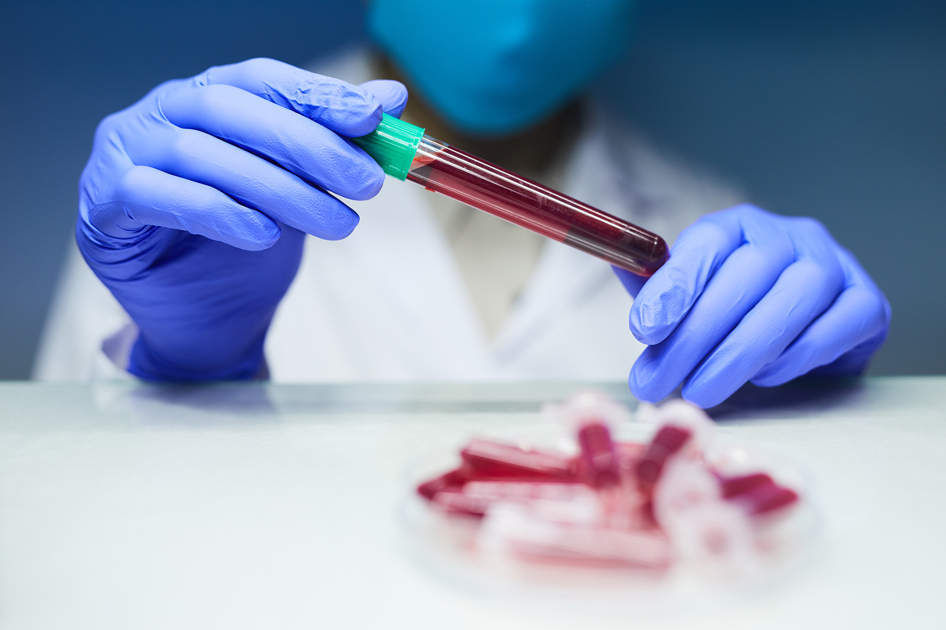 Cardiac Profile Basic Test: Blood Tests for Heart Disease