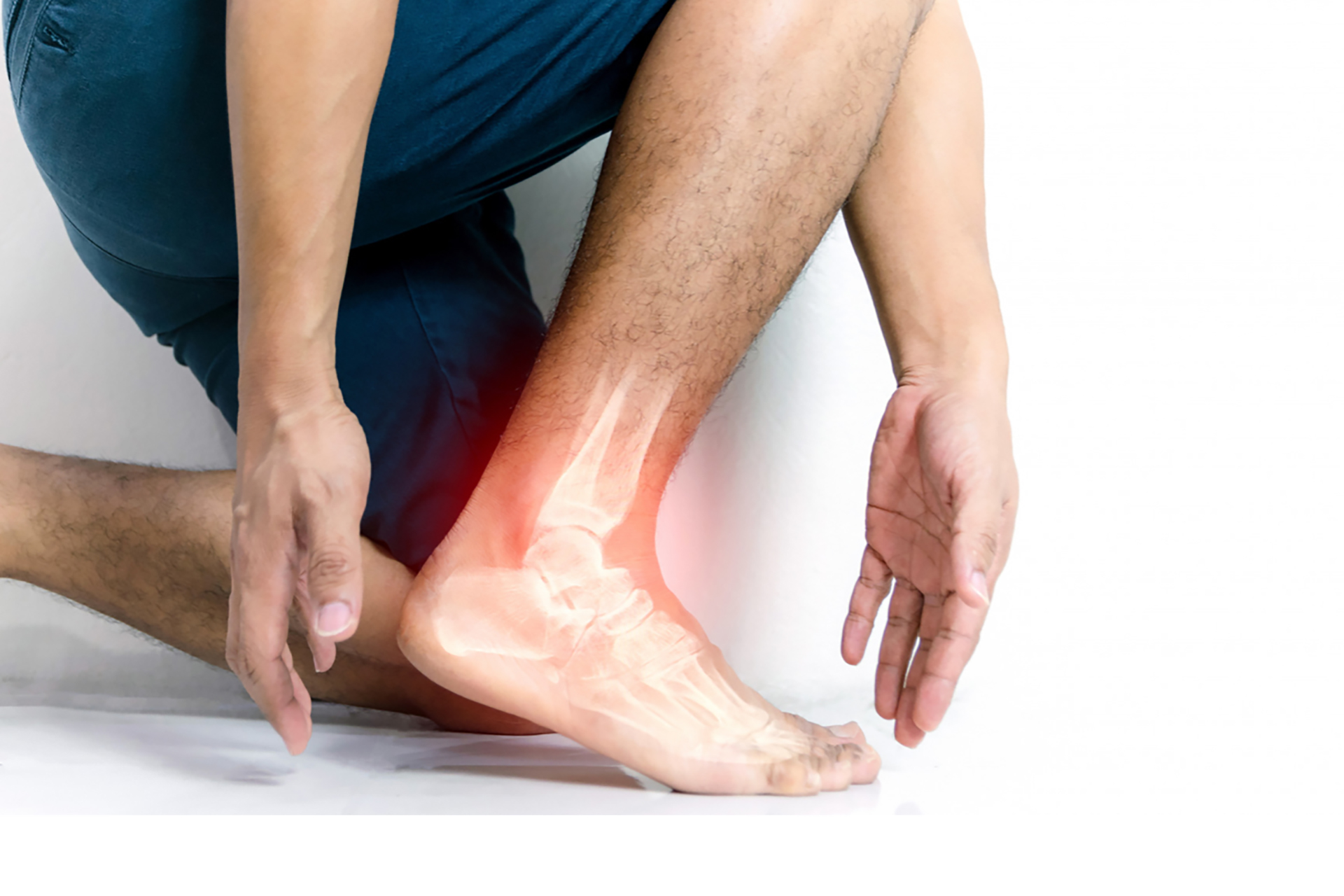 8 Easy Ways to Heal Athlete's Foot