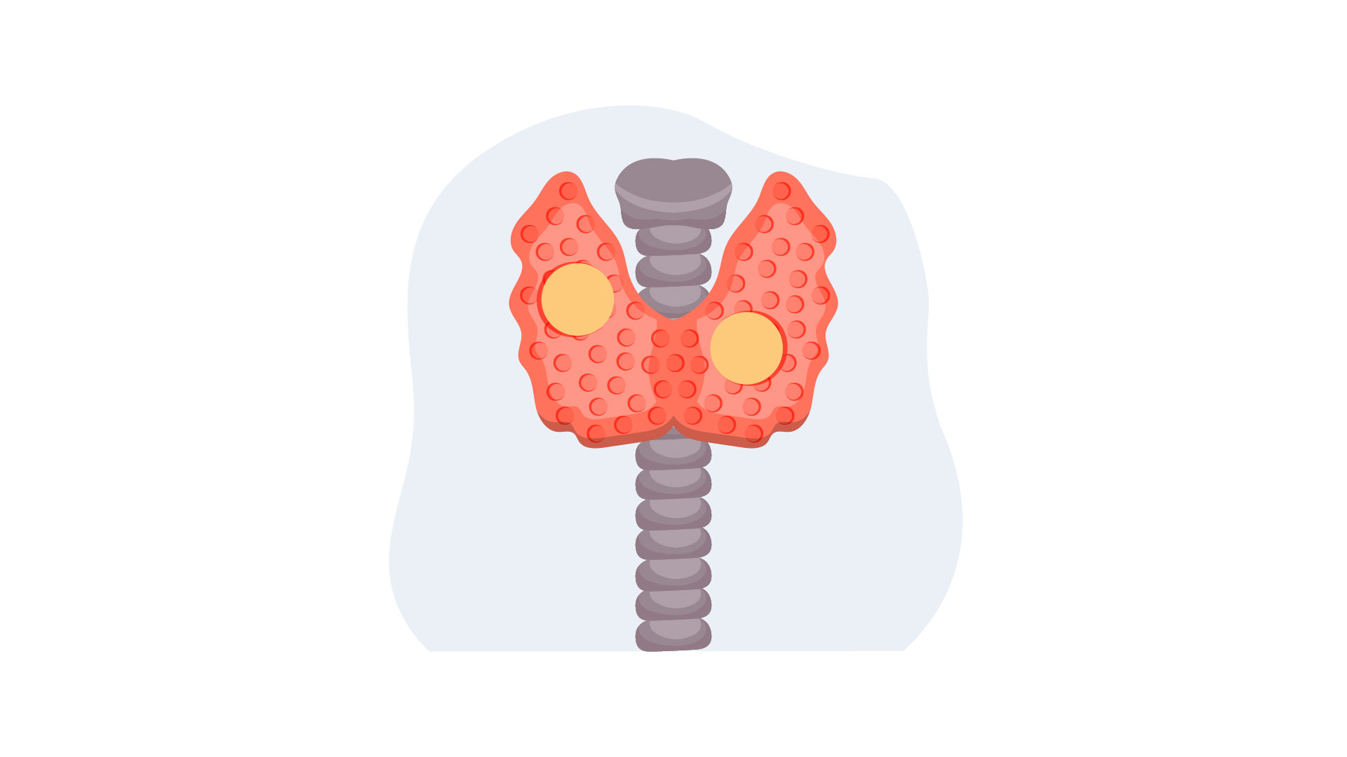 Thyroid Nodules: Symptoms, Causes and Treatment