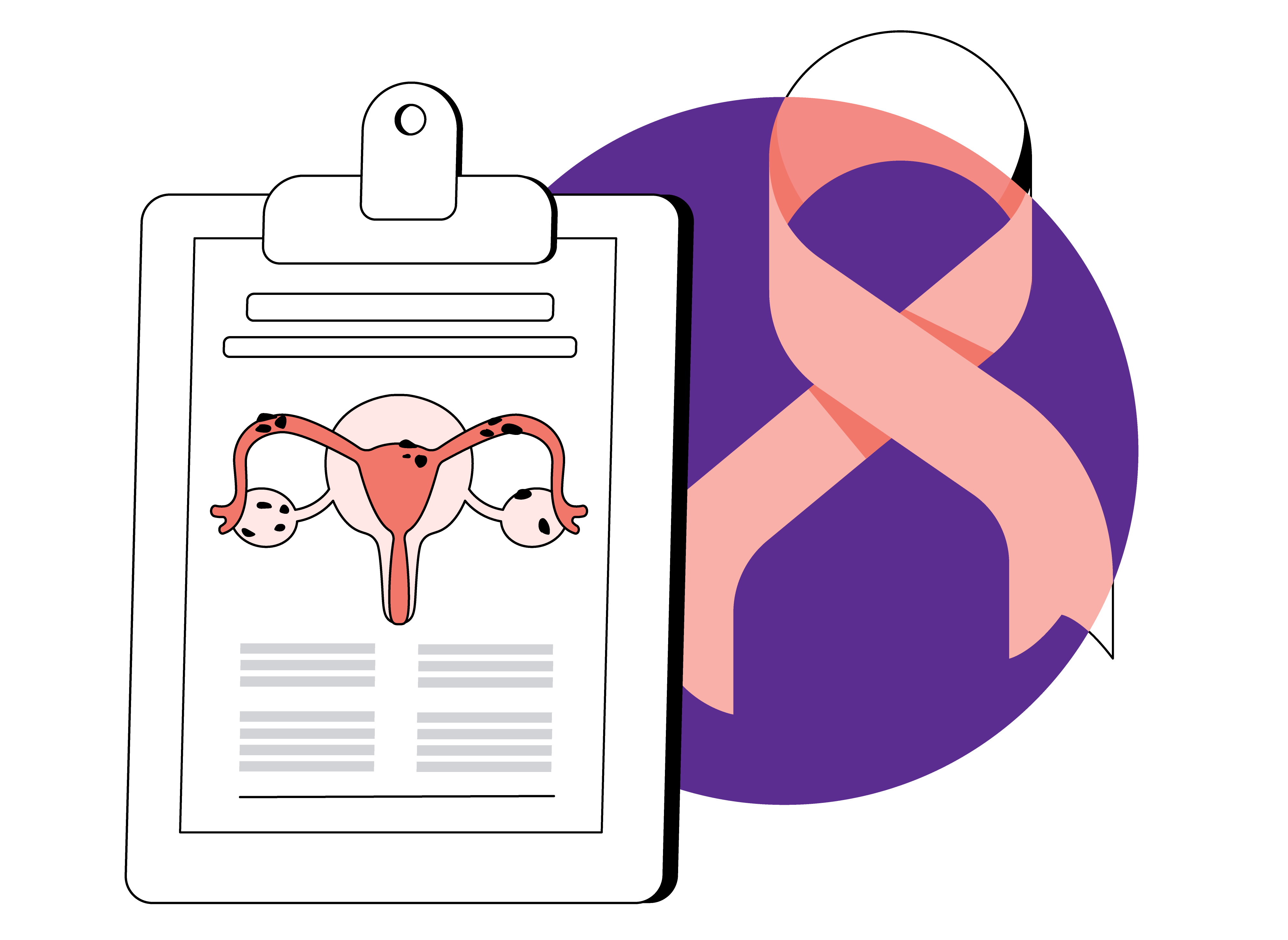 Endometrial Cancer Symptoms Causes And Treatment