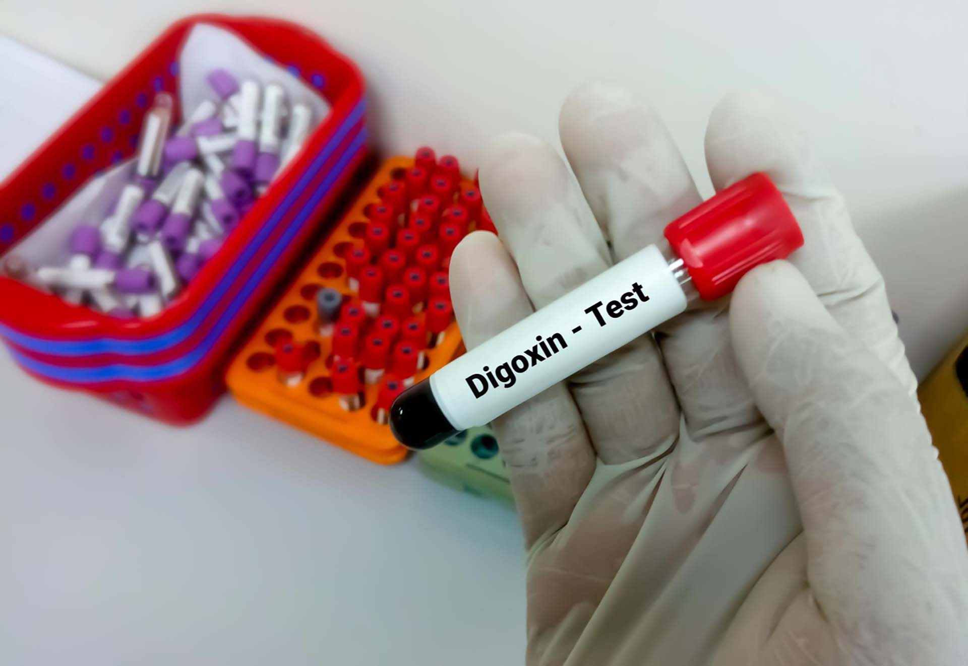 Digoxin test Purpose, Procedure, Result and Risks