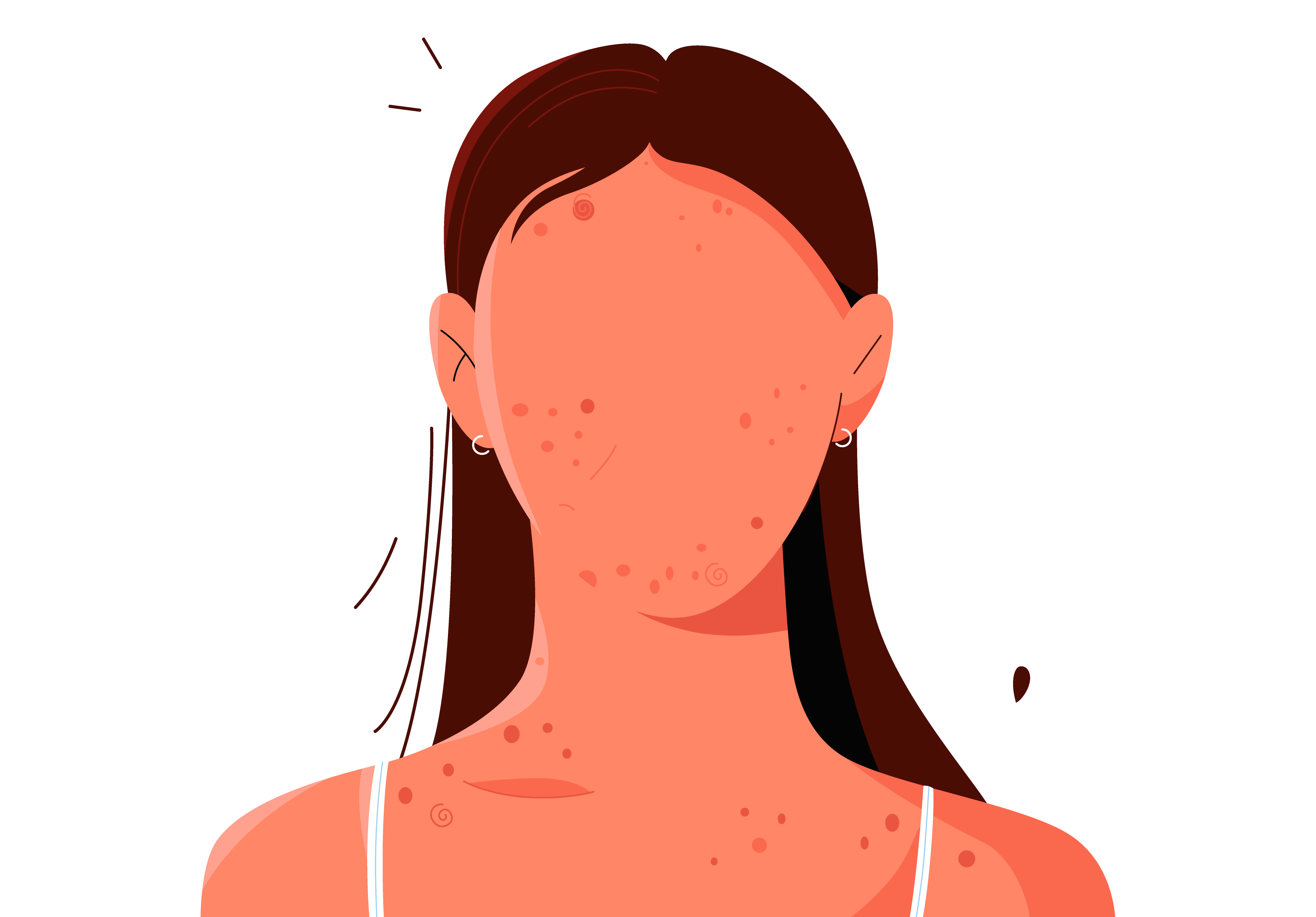 Acne Homeopathic Remedy: Causes and Misconceptions
