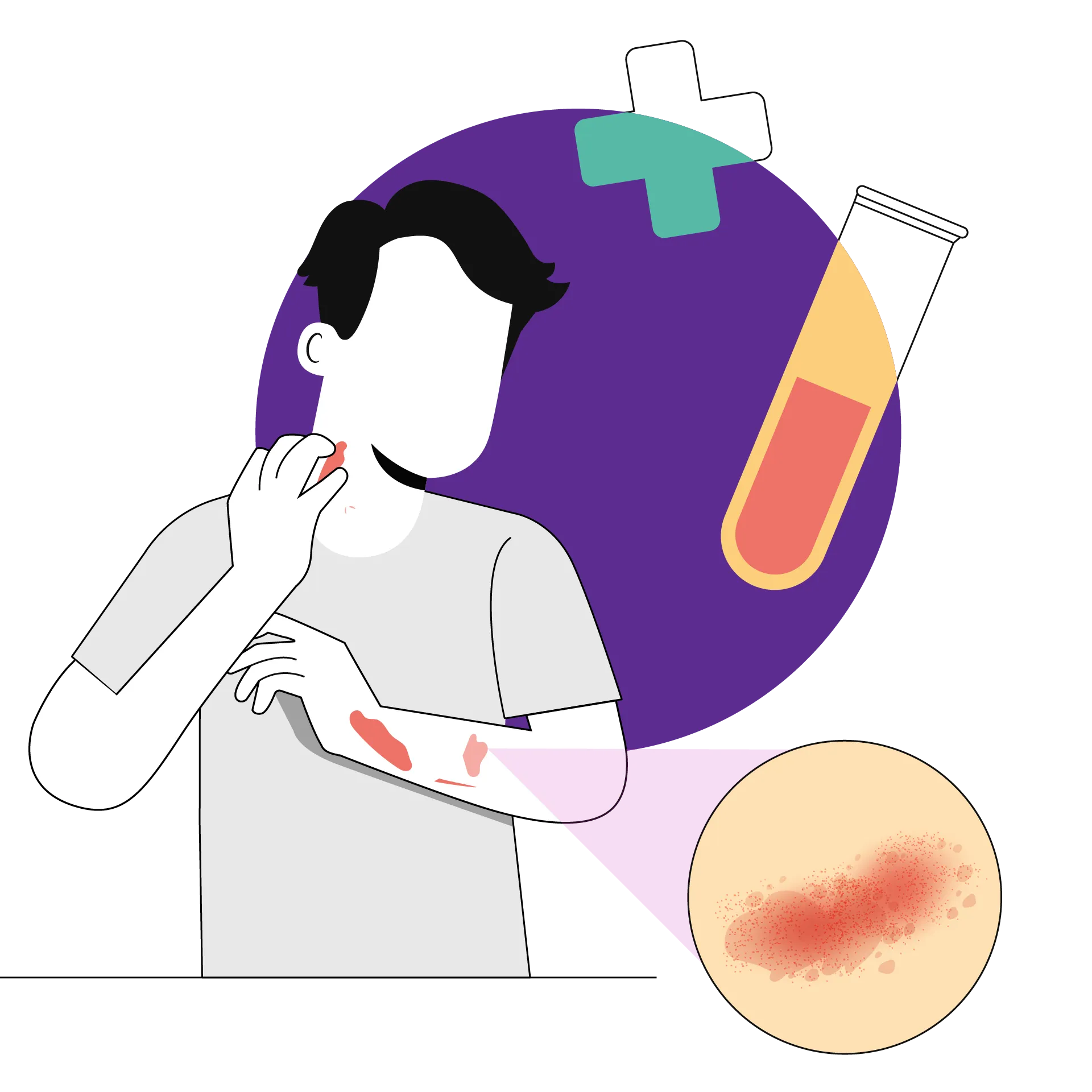 Tuberculin Skin Test illustrations