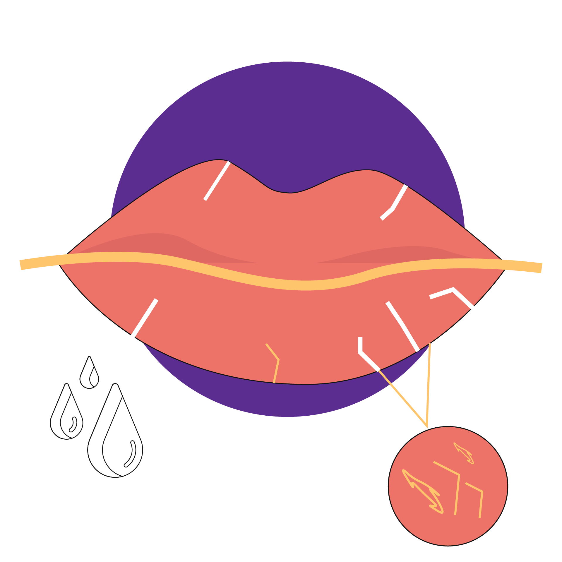 Dry Mouth (Xerostomia) Causes, Symptoms and Home Remedies