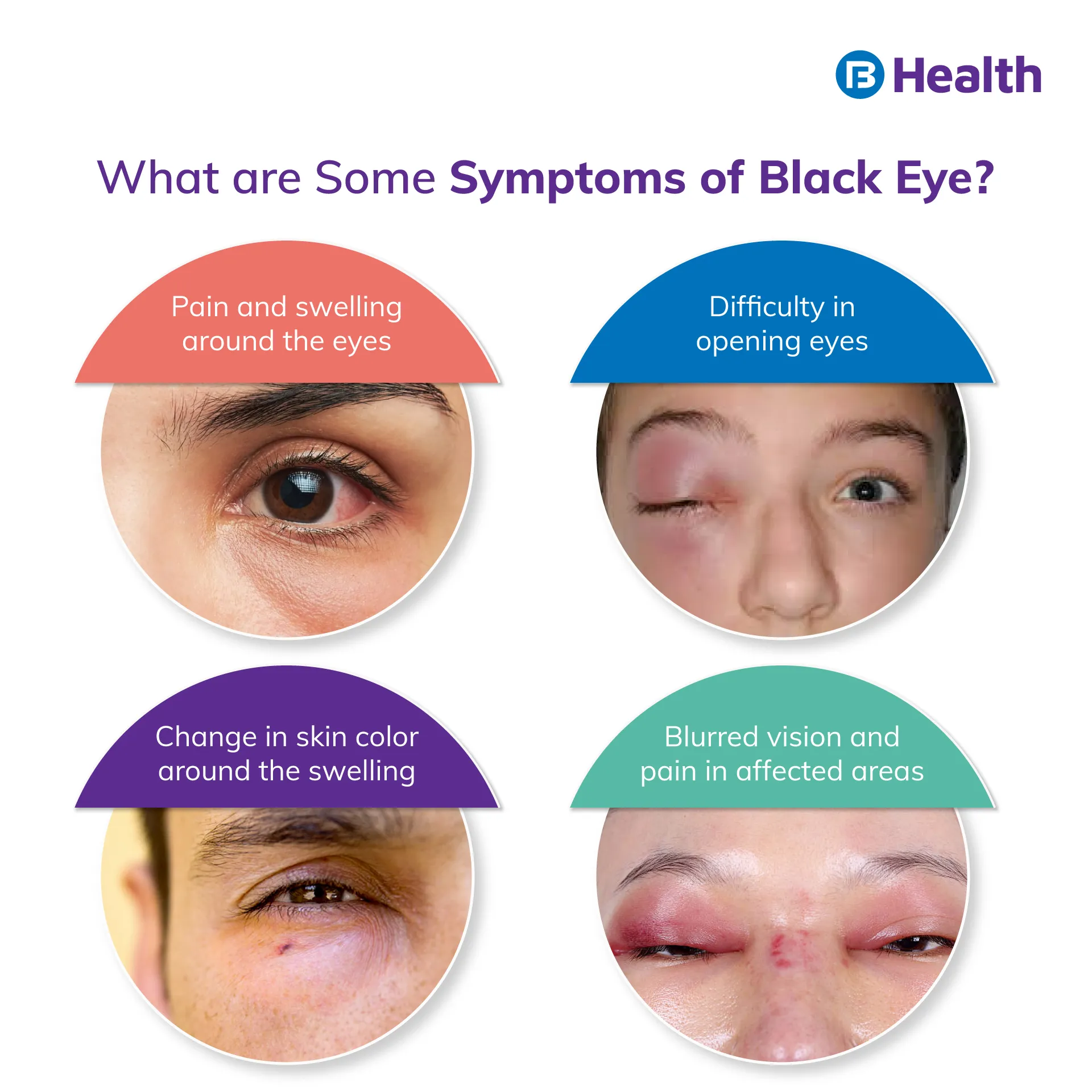 what are the symptoms of Black Eye - 7