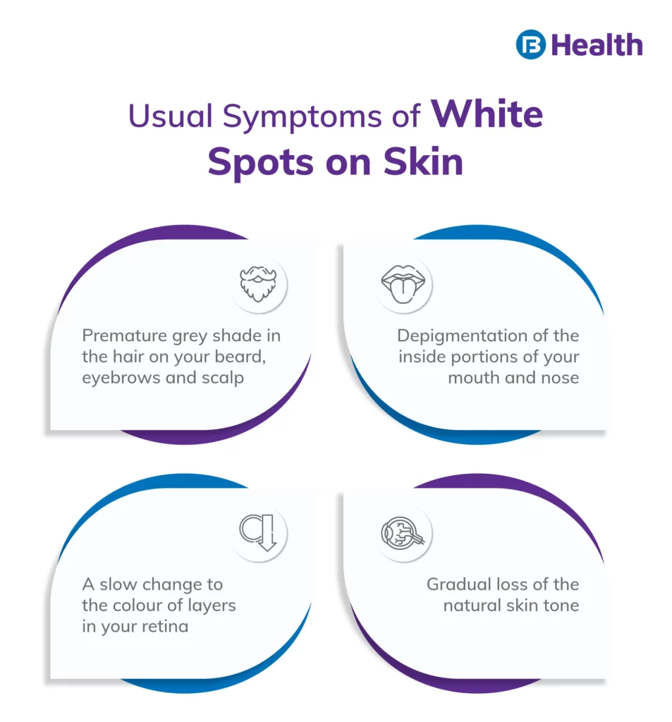 7-White Spots on Skin: 