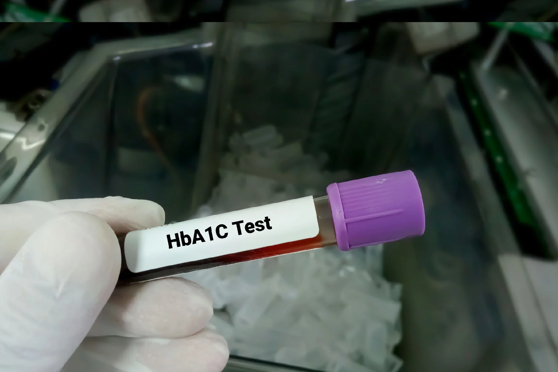 HbA1c সাধারণ পরিসর: HbA1c টেস্টের মাধ্যমে ডায়াবেটিস স্ক্যান করতে হয়