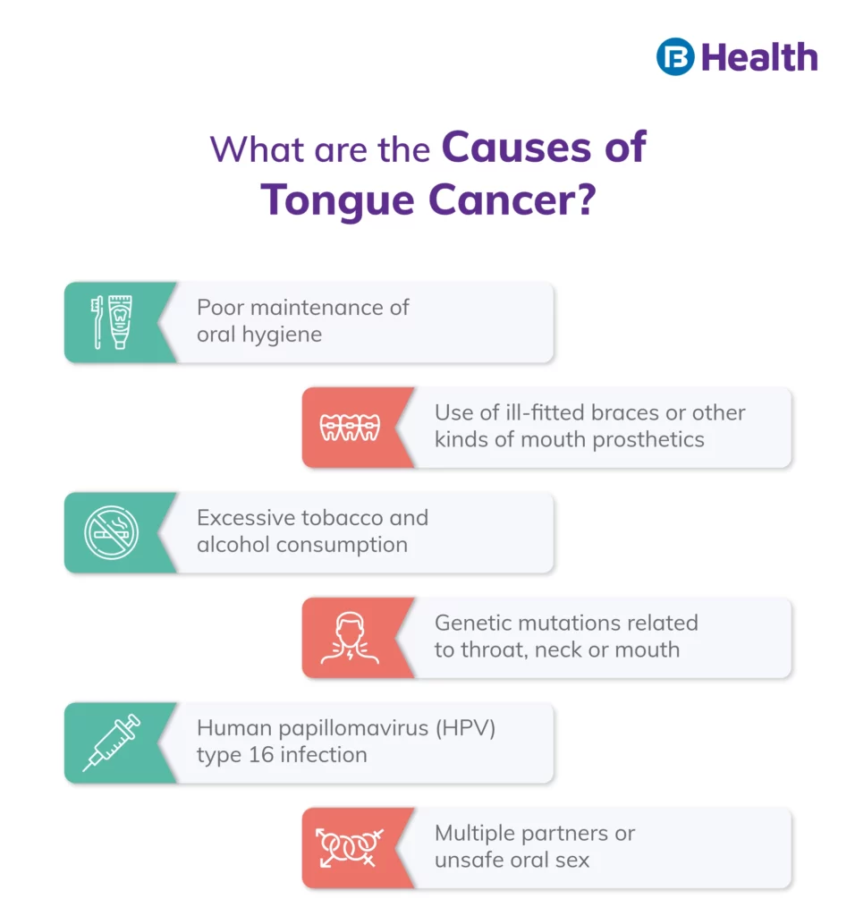 IG 30 jan-Tongue Cancer