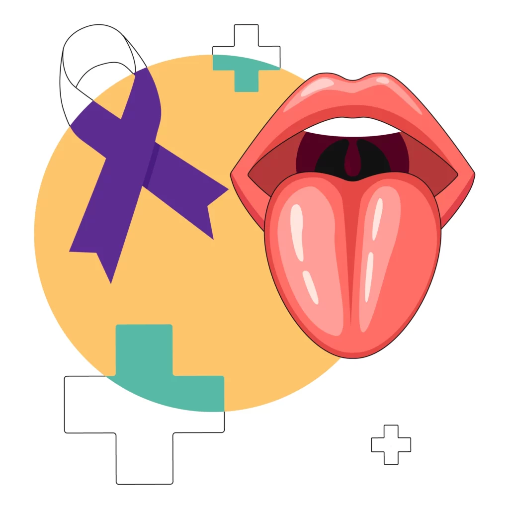 ill 30 jan-Tongue Cancer
