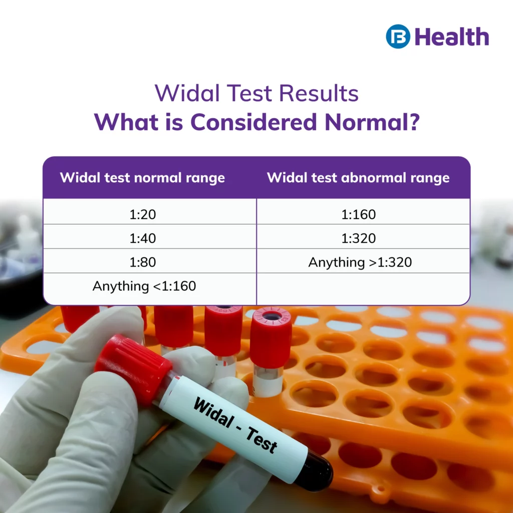 Widal Test Result infographic