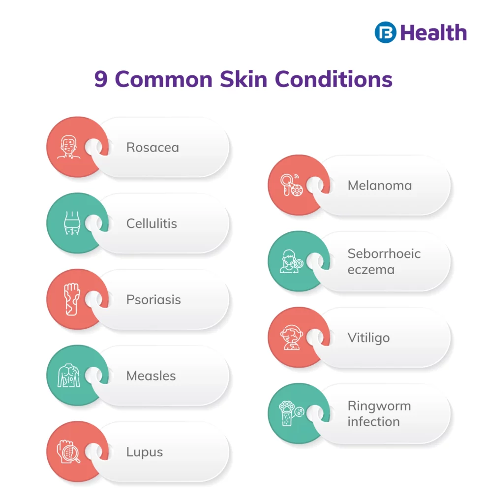 Common skin Condition infographic
