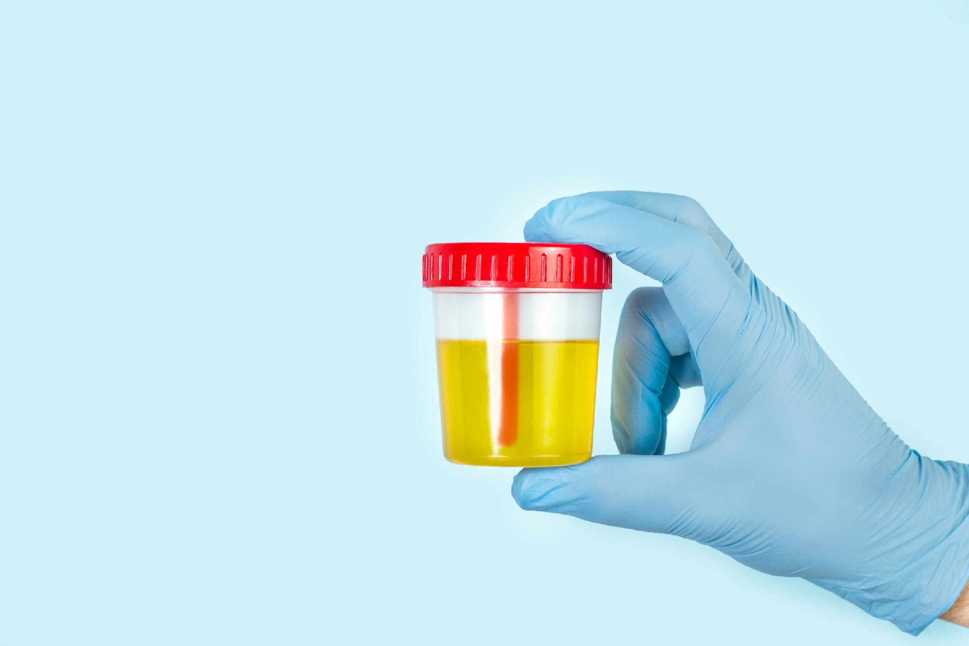 Blood in Urine: Reasons Behind and Ways to Cure It