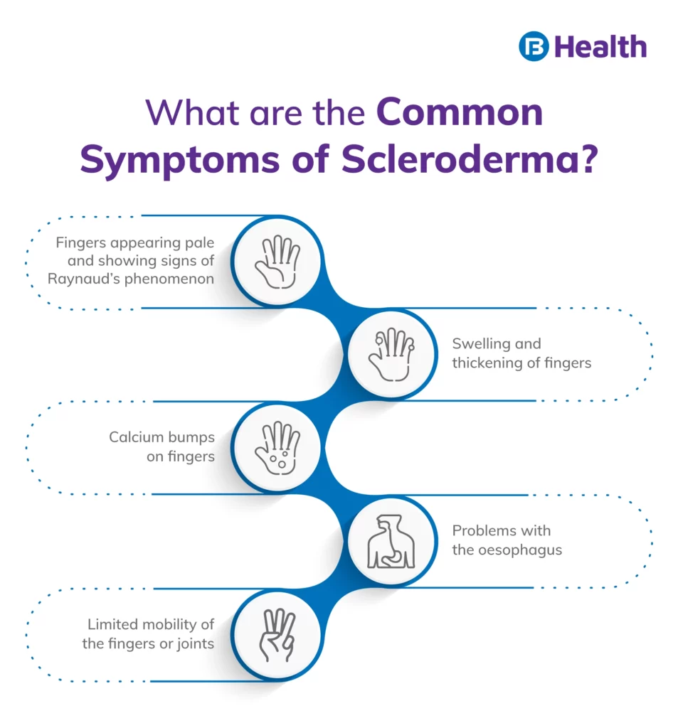Some Common Symptoms of Scleroderma Infographic