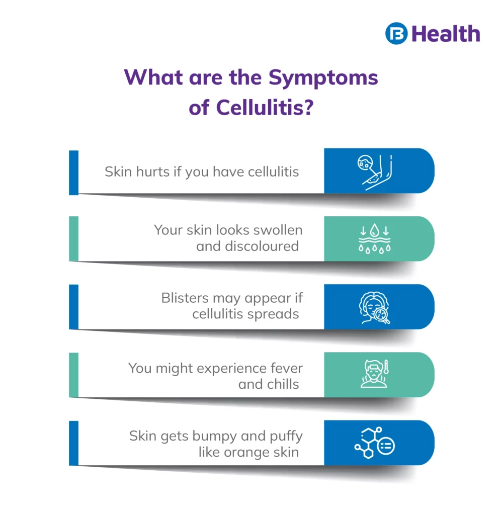Cellulitis Signs and Symptoms Infographic 