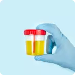 Blood In Urine (Hematuria): Meaning, Factors, Complications, Treatment