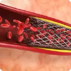 MCV Blood Test : Definition, Purpose and Normal MCV Range