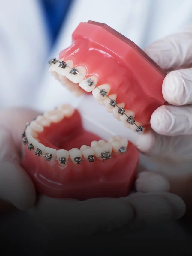 5 Signs Of Cavity That You Should Not Ignore